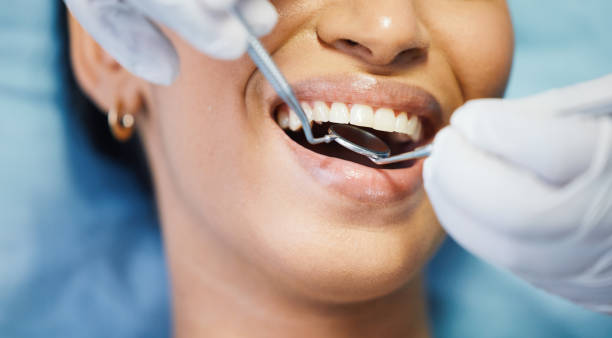 Best Emergency Treatment for Dental Infections or Abscesses in New Hope, MN