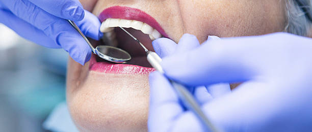 Best Urgent Care for Lost Fillings or Crowns in New Hope, MN